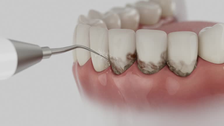 Trusted Wisdom Tooth Removal service in Rosewood Heights, IL - Dentist Open Now